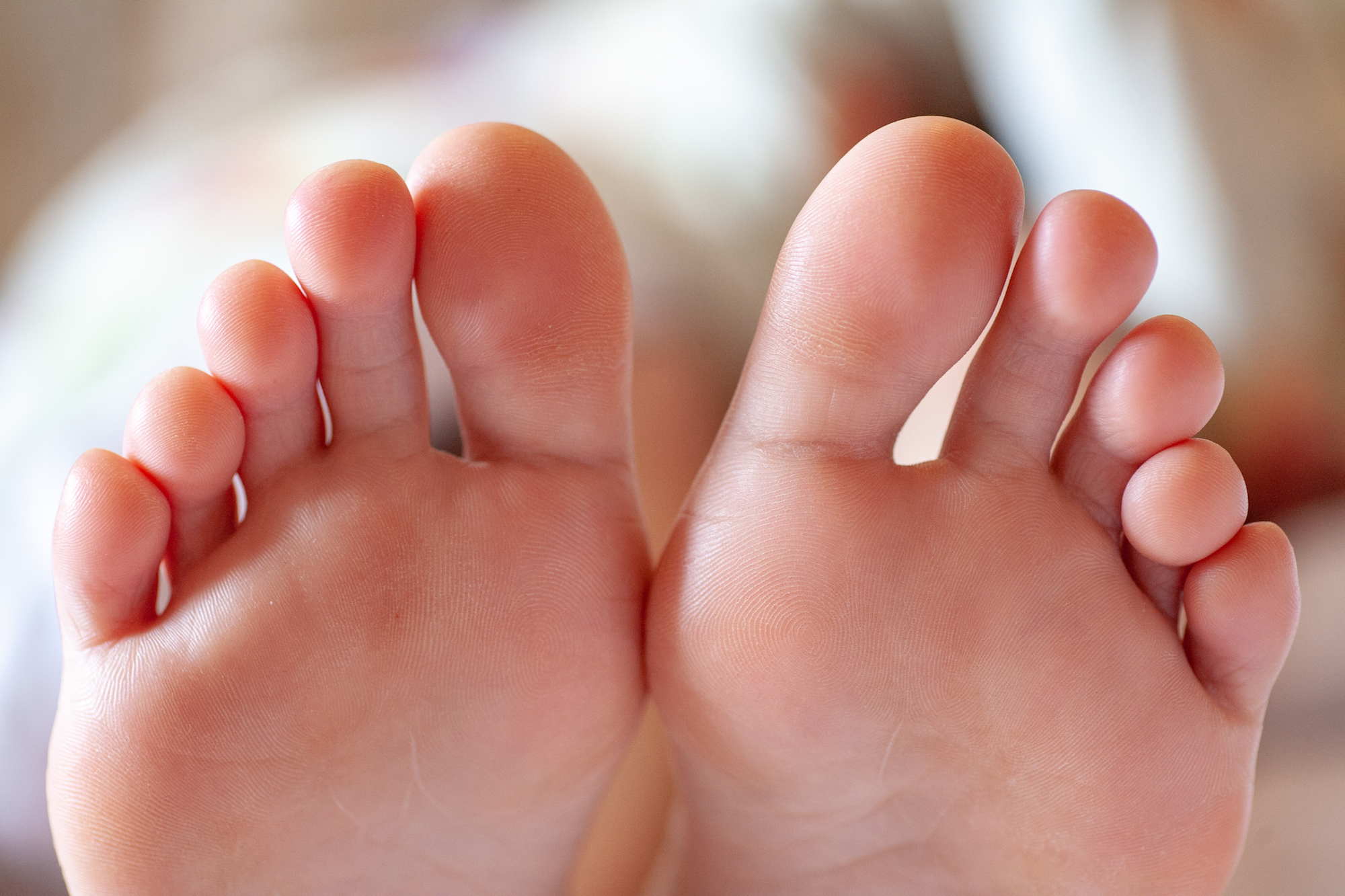 covid-toes-rashes-how-the-coronavirus-can-affect-your-skin